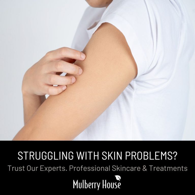 Chicken Skin: Causes and Treatments