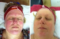 Private Skin Treatments