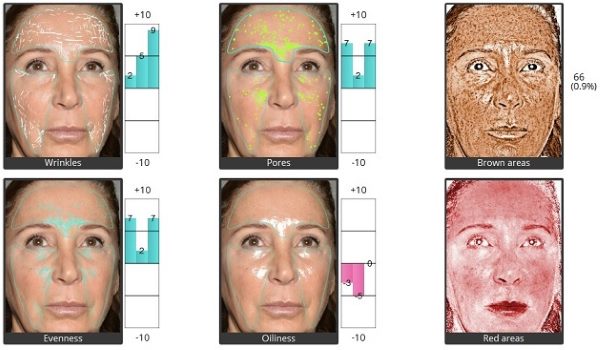New Detailed Skin Analysis