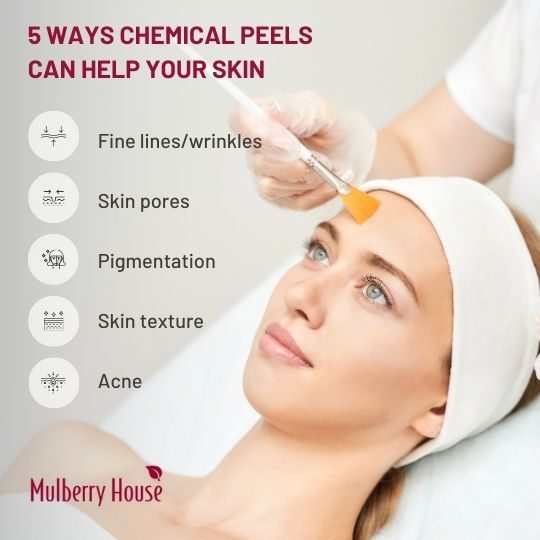 5 benefits chemical peels