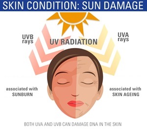 zo skin health sun damage