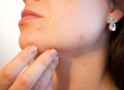 Beat the Onset of Autumn Acne