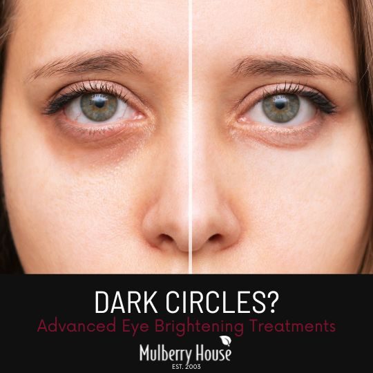 dark circles eye brightening treatments